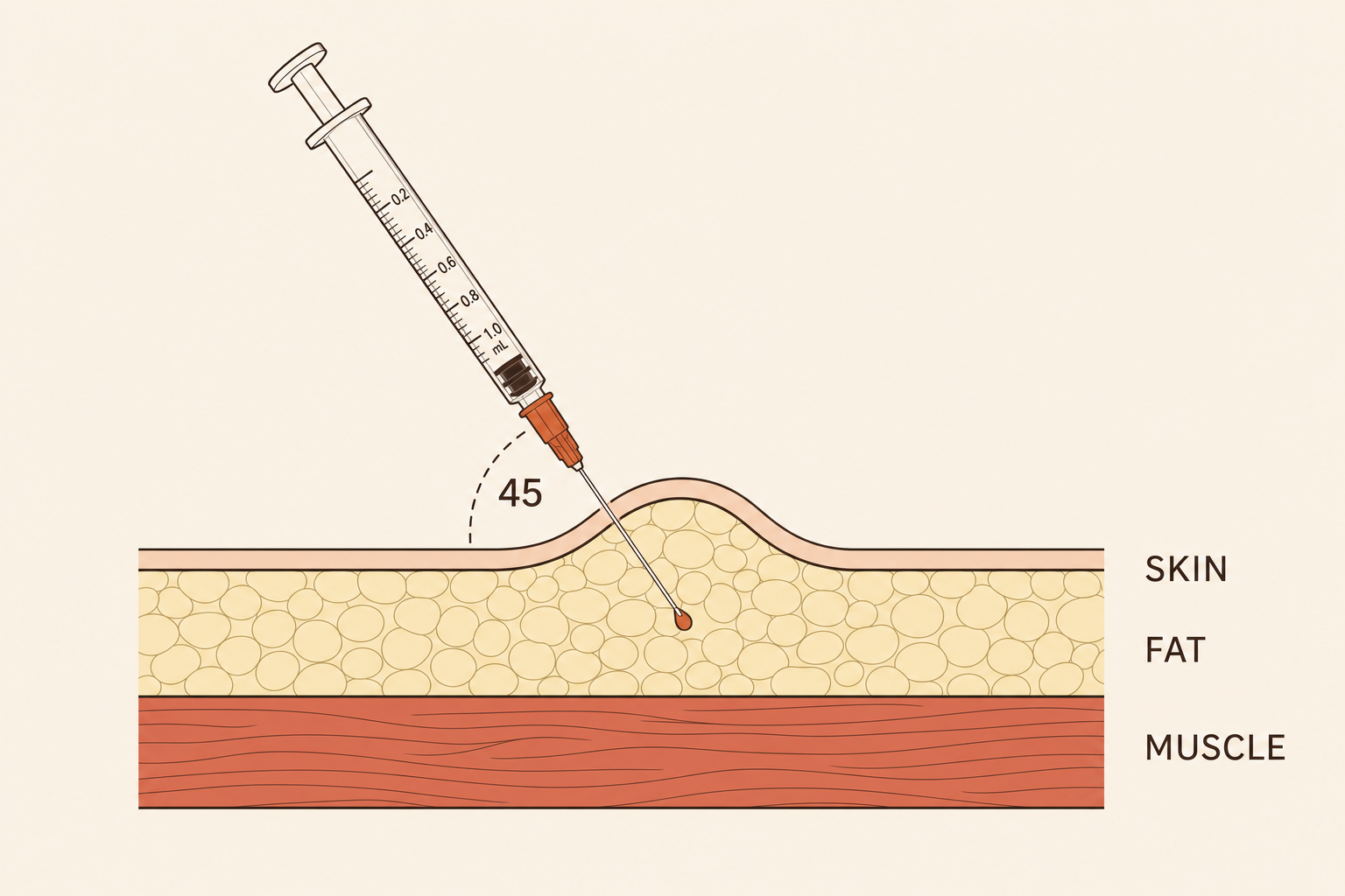 Cross-section illustration of a needle entering the subcutaneous fat layer at 45 degrees