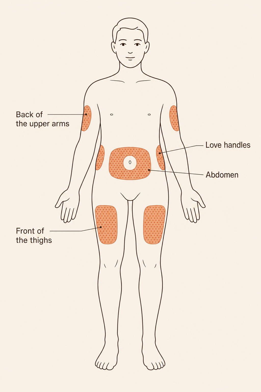 Body diagram showing subcutaneous injection sites: abdomen, love handles, thigh, upper arm